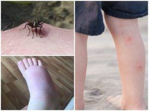 Комары — фото и описание, виды комаров, откуда они берутся