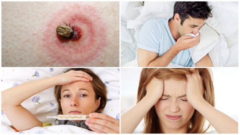 Симптомы после укуса клеща: первые симптомы заболеваний