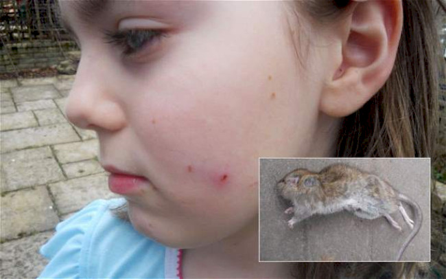 Укус крысы, что делать, если укусил ребенок, опасно ли это?