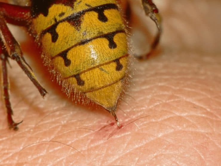 Укус шмеля и его последствия: что делать в домашних условиях, если вас укусило опасное насекомое?