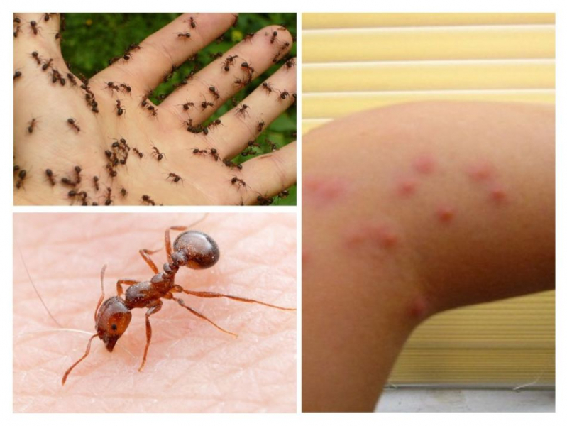 Укусы муравьев: фото и лечение, чем лечить и окрашивать укусы муравьев
