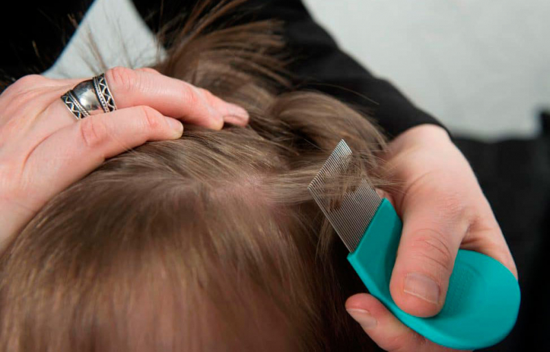 Как лечить головных вшей у детей в домашних условиях?